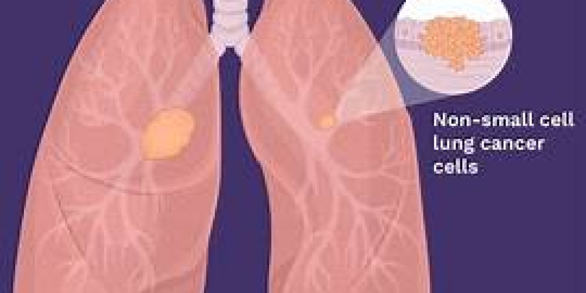 Non-Small Cell Lung Cancer Market Size, Share, and Growth Analysis