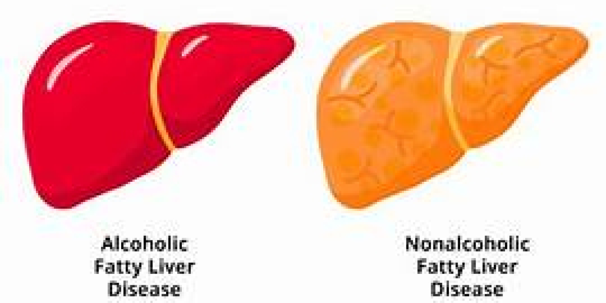 Non-Alcoholic Fatty Liver Disease (NAFLD) Market Size, Share, and Growth Prospects